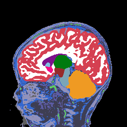 Transforming Infant Brain Imaging: BabySeg’s Groundbreaking Multi-Modal MRI Segmentation