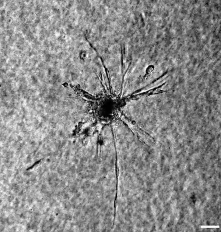 Breaking Free: How Cell Strain-Stiffening Unlocks Escape from Tumor Spheroids