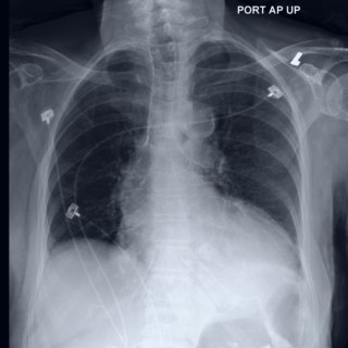 Revolutionizing Clinical Diagnosis: The Power of Ranking-Aware Prompt Optimization!